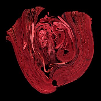Cara Barer -&nbsp;Heart Sizes vary